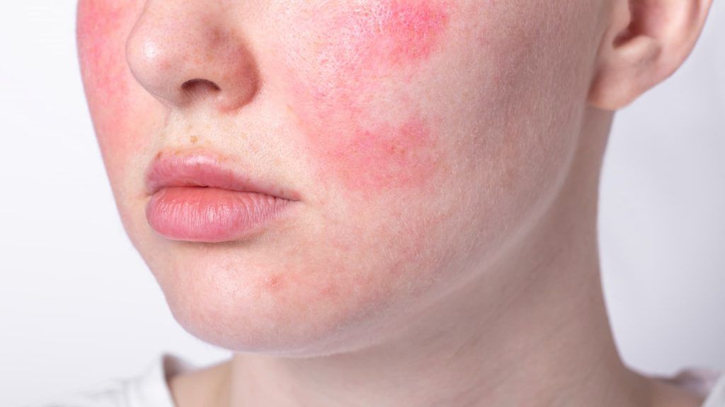 a close up of a person's face