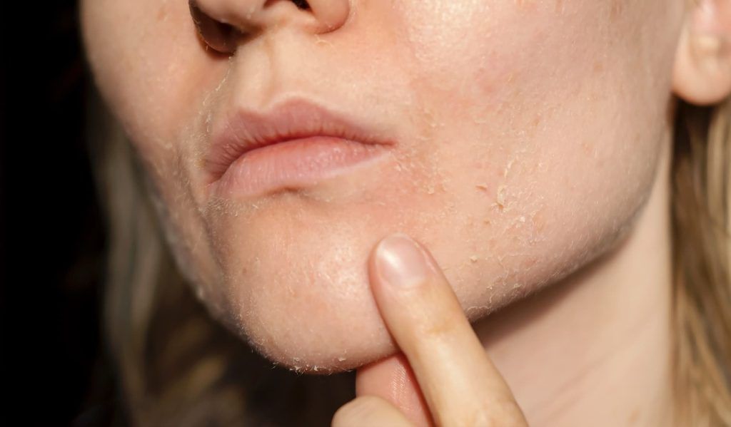 a person touching her chin