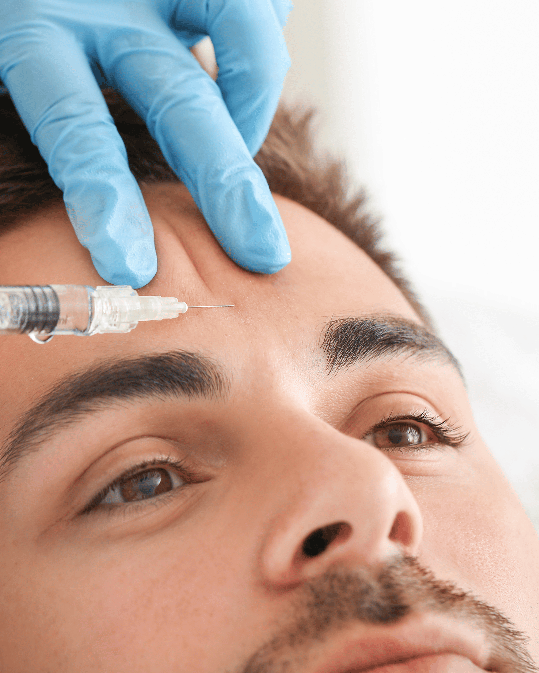 botox for men
